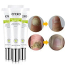 Gel Antifungo Efero