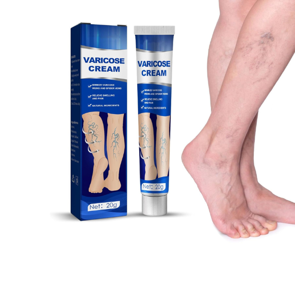 Pomada  Varicose Cream – Para Varizes, Vasculite e Flebite